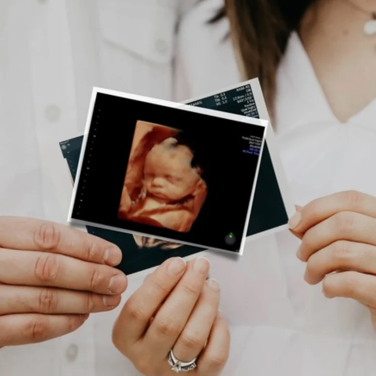 Ultrasound