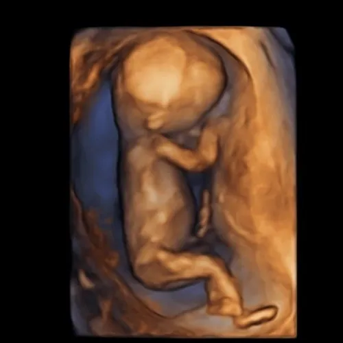 Imagen real de ultrasonido de recuerdo en Preggoland Mamas