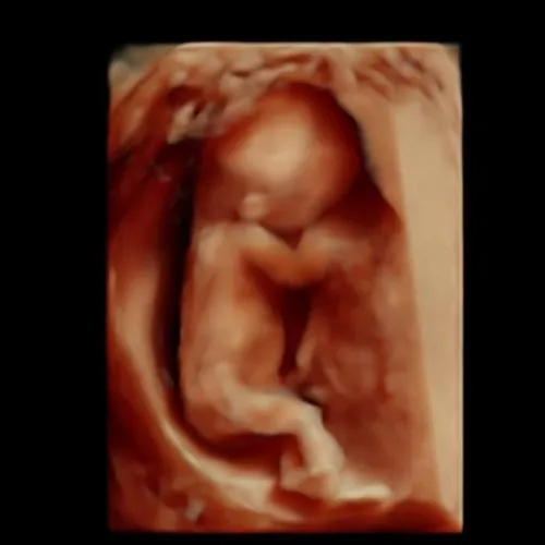 Imagen real de ultrasonido de recuerdo en Preggoland Mamas