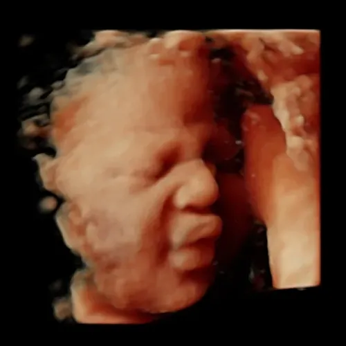 Imagen real de ultrasonido de recuerdo en Preggoland Mamas