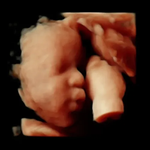 Imagen real de ultrasonido de recuerdo en Preggoland Mamas