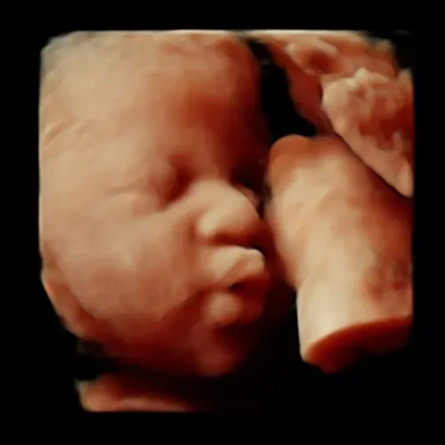 Imagen real de ultrasonido de recuerdo en Preggoland Mamas