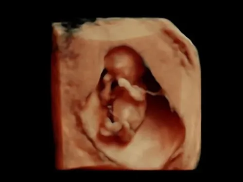 Imagen real de ultrasonido de recuerdo en Preggoland Mamas