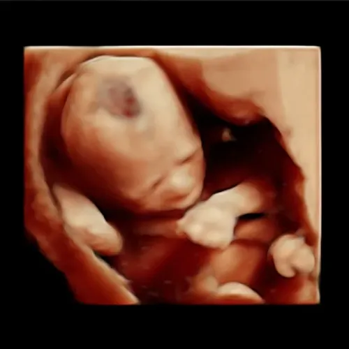 Imagen real de ultrasonido de recuerdo en Preggoland Mamas
