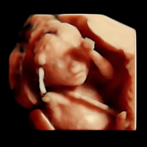 Imagen real de ultrasonido de recuerdo en Preggoland Mamas