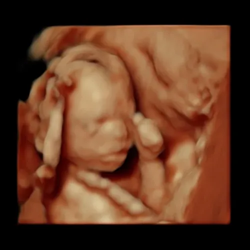 Imagen real de ultrasonido de recuerdo en Preggoland Mamas