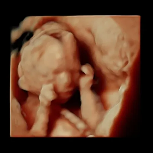 Imagen real de ultrasonido de recuerdo en Preggoland Mamas