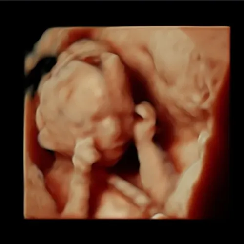 Imagen real de ultrasonido de recuerdo en Preggoland Mamas
