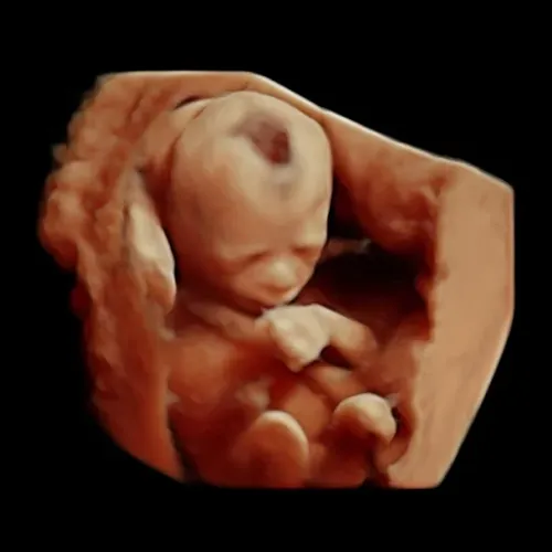 Imagen real de ultrasonido de recuerdo en Preggoland Mamas