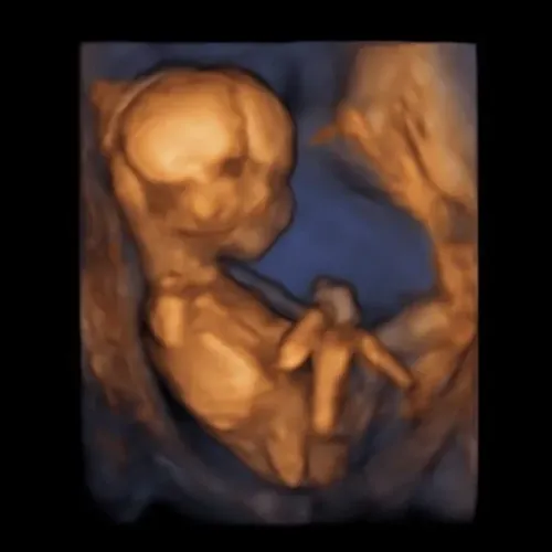 Imagen real de ultrasonido de recuerdo en Preggoland Mamas