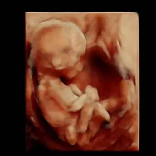 Imagen real de ultrasonido de recuerdo en Preggoland Mamas