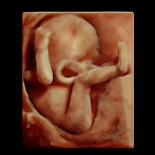 Real keepsake ultrasound image from Preggoland Mamas