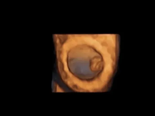 Imagen real de ultrasonido de recuerdo en Preggoland Mamas
