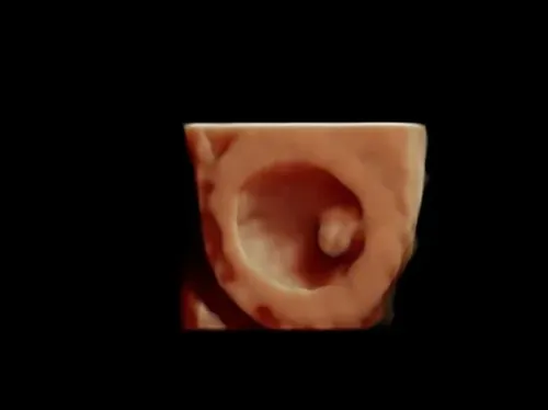 Imagen real de ultrasonido de recuerdo en Preggoland Mamas