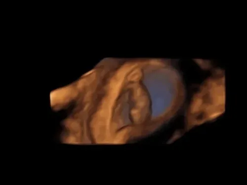 Imagen real de ultrasonido de recuerdo en Preggoland Mamas