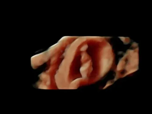 Imagen real de ultrasonido de recuerdo en Preggoland Mamas