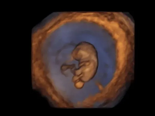 Imagen real de ultrasonido de recuerdo en Preggoland Mamas