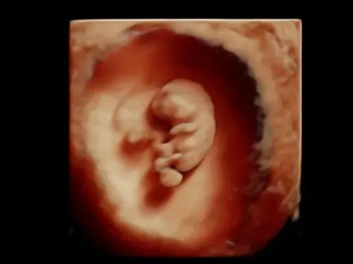 Imagen real de ultrasonido de recuerdo en Preggoland Mamas