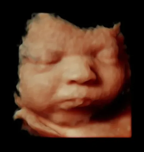 Imagen real de ultrasonido de recuerdo en Preggoland Mamas