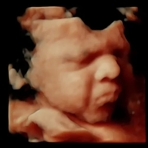 Imagen real de ultrasonido de recuerdo en Preggoland Mamas