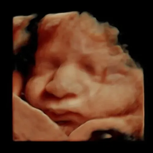 Imagen real de ultrasonido de recuerdo en Preggoland Mamas