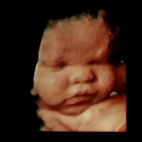 Imagen real de ultrasonido de recuerdo en Preggoland Mamas