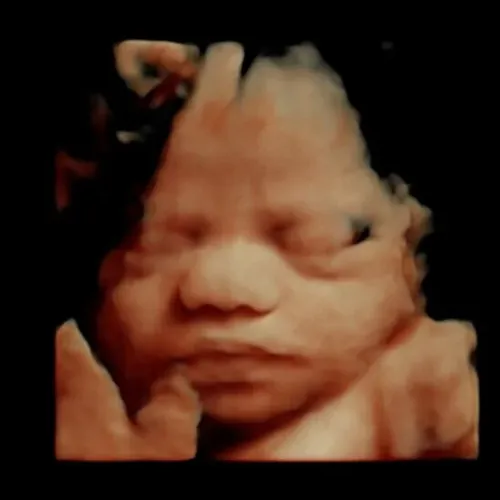Imagen real de ultrasonido de recuerdo en Preggoland Mamas