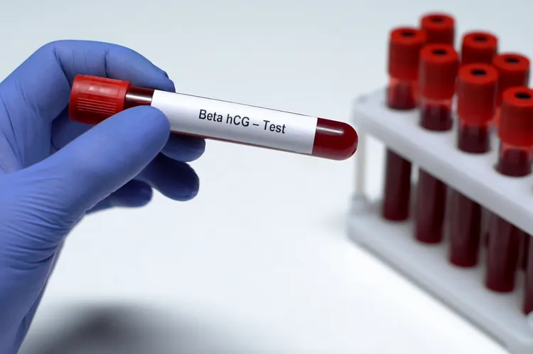 Quantitative hCG