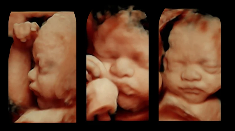 Real keepsake ultrasound image from Preggoland Mamas